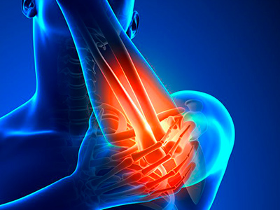 Ellenbogenschmerzen, Ellenbogenchirurgie
