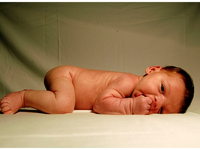 Kinderorthopädie, Säuglings- Hüftultraschall